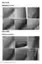 Fig. 84 - Compositions containing HC-HA/PTX3 complexes and methods of use thereof