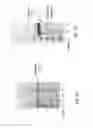 Fig. 02 - Purification of virus like particles