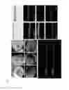 Fig. 07 - Method for producing cultivated epithelial cell sheet