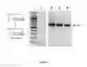 Fig. 06 - Nucleic acids and methods for the treatment of Pompe disease