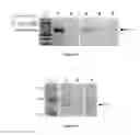 Fig. 08 - Nucleic acids and methods for the treatment of Pompe disease