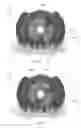 Fig. 33 - Portable molecular diagnostic device and methods for the detection of target viruses
