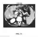 Fig. 22 - Process for microsatellite instability detection