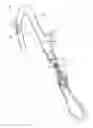 Fig. 01 - Sensor-operated pull-out faucet
