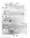 Fig. 07 - Composite construct and methods and devices for manufacturing the same