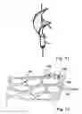 Fig. 06 - FUNCTIONAL ELEMENT, IN PARTICULAR FLUID PUMP, HAVING A HOUSING AND A CONVEYING ELEMENT