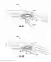 Fig. 03 - Cable actuator guide for liquid dispenser and associated methods