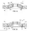 Fig. 06 - Torque Retention Arrangement