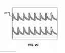 Fig. 05 - Optical encoder for detecting crown movement