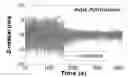 Fig. 01 - Antibiotic susceptibility testing via plasmonic imaging and tracking