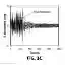 Fig. 07 - Antibiotic susceptibility testing via plasmonic imaging and tracking