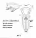 Fig. 02 - METHODS AND COMPOSITIONS FOR DETECTING ENDOMETRIAL OR OVARIAN CANCER