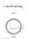 Fig. 04 - Tunable RF coil for magnetic resonance imaging