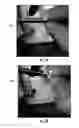 Fig. 09 - Bend induced light scattering fiber and cable assemblies and method of making