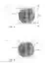 Fig. 07 - Folded camera lens designs