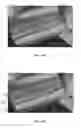 Fig. 05 - Local tone mapping for symbol reading
