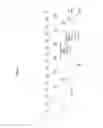 Fig. 12 - Method and apparatus for encoding/decoding a video using a motion compensation