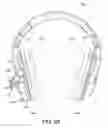 Fig. 08 - Spatial low-crosstalk headset