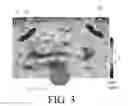 Fig. 04 - Hearing device or system adapted for navigation