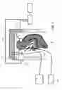 Fig. 02 - Method for producing acoustic trauma deafness model animal, and acoustic trauma deafness model animal produced by the same