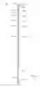 Fig. 02 - Single piece hammock strap with integral woven eyelets
