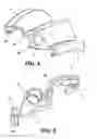 Fig. 02 - Converter device for laryngoscopy