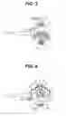 Fig. 04 - Endoscope operation portion and endoscope