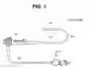 Fig. 02 - ENDOSCOPE