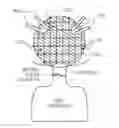 Fig. 01 - DEVICES AND METHODS FOR ATRIAL MAPPING, SENSING AND TREATING CARDIAC ARRHYTHMIA