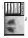 Fig. 08 - Mobile radiography calibration for tomosynthesis using epipolar geometry