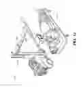 Fig. 13 - Mobile radiography calibration for tomosynthesis using epipolar geometry