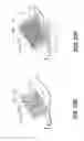 Fig. 25 - Mobile radiography calibration for tomosynthesis using epipolar geometry