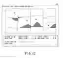 Fig. 11 - ULTRASONIC DIAGNOSTIC APPARATUS, MEDICAL IMAGE PROCESSING APPARATUS, AND METHOD FOR CALCULATING PLAQUE SCORE