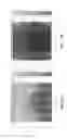 Fig. 09 - Calibration for ARFI imaging