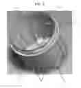 Fig. 06 - Ergonomic stool specimen container and enclosing holder systems, methods, and kits