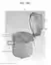 Fig. 30 - Ergonomic stool specimen container and enclosing holder systems, methods, and kits