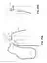 Fig. 85 - Suture passer devices and methods