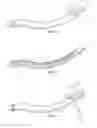 Fig. 03 - Surgical instrument for manipulating and passing suture