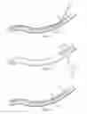Fig. 04 - Surgical instrument for manipulating and passing suture