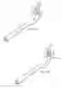 Fig. 16 - Surgical instrument for manipulating and passing suture