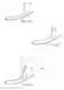 Fig. 19 - Surgical instrument for manipulating and passing suture