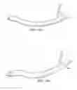 Fig. 25 - Surgical instrument for manipulating and passing suture