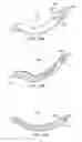 Fig. 30 - Surgical instrument for manipulating and passing suture