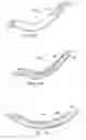 Fig. 32 - Surgical instrument for manipulating and passing suture
