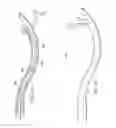 Fig. 54 - Surgical instrument for manipulating and passing suture