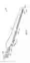 Fig. 22 - Robotic assisted clip applier