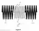 Fig. 06 - Implant detachment