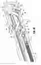 Fig. 06 - Reposable multi-fire surgical clip applier