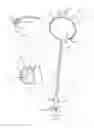 Fig. 02 - Thrombectomy catheter and methods of use