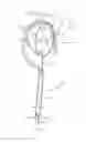 Fig. 06 - Thrombectomy catheter and methods of use